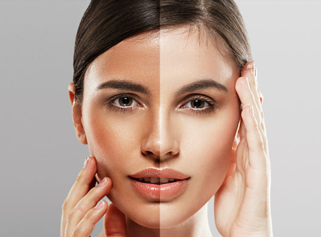 skinlightening.jpg
