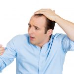 Male Pattern Baldness