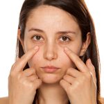 How to Remove Dark Circles Under Eyes