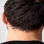 How to get rid of dandruff