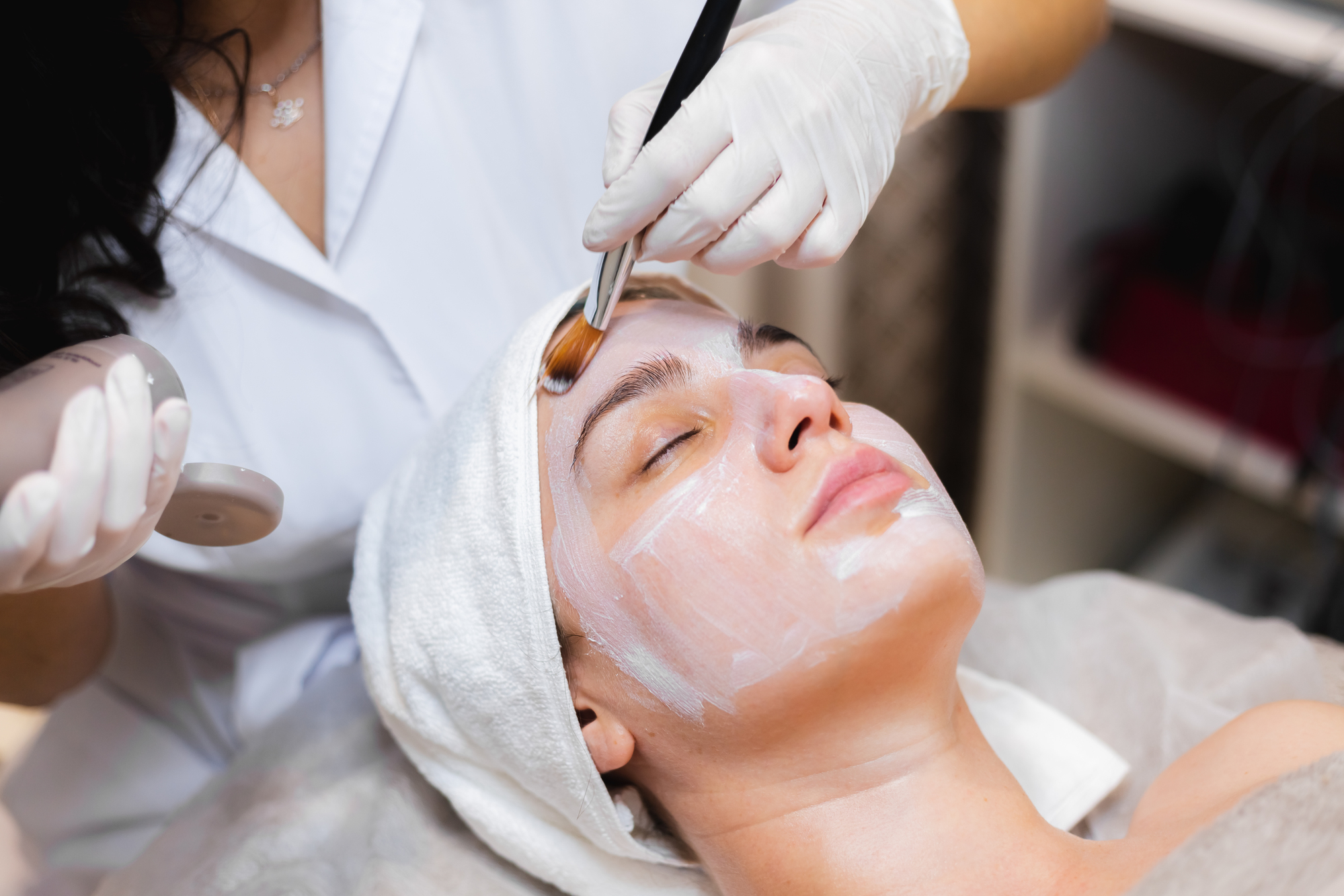 Chemical Peel Treatment