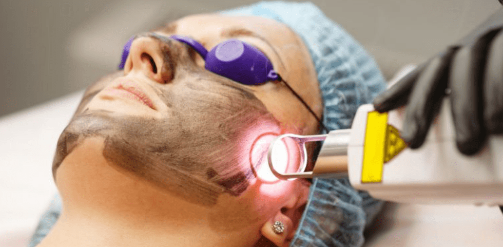 Laser Skin Treatments in India - Benefits, Cost & Side Effects