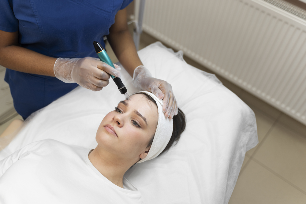 MNRF Treatment