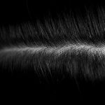 Scalp Fungus Treatment Home Remedies, Causes & Symptoms