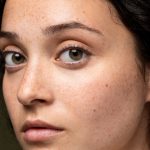 Tiny Black Dots on Face