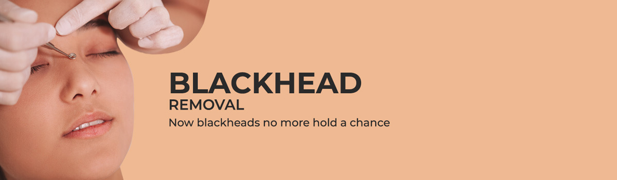 Blackhead and Whitehead Removal
