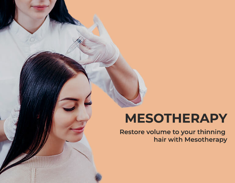 Mesotherapy Treatment For Hair in Bangalore