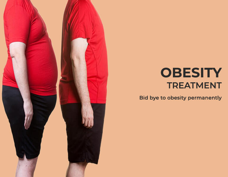 Obesity Treatment in Chennai