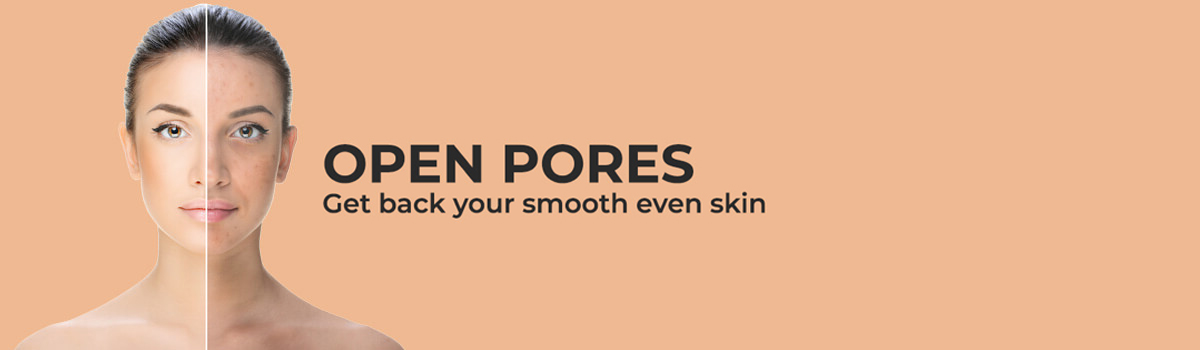 Open Pores Treatment