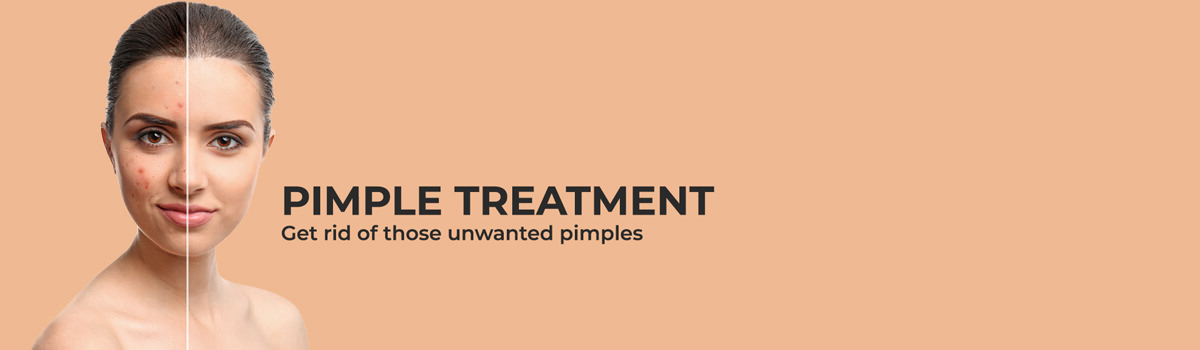 Pimple Treatment in Bangalore